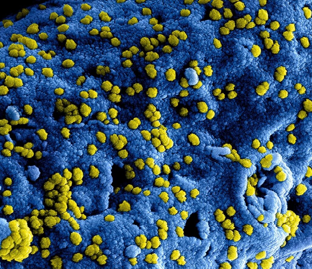 Microbial Life: A Universe at the Edge of Sight